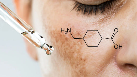 Tout savoir sur l'Acide Tranexamique : un actif à l'impact thérapeutique sur la Peau