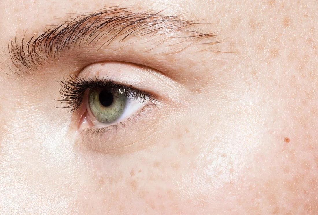 Comment se débarrasser des cernes : les solutions pour retrouver un regard frais et reposé