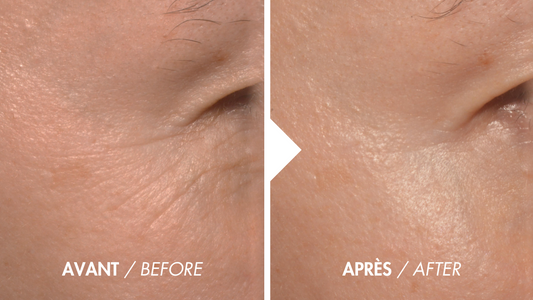 Avant / Après : quels résultats peut-on vraiment attendre du masque LED pour le visage ?