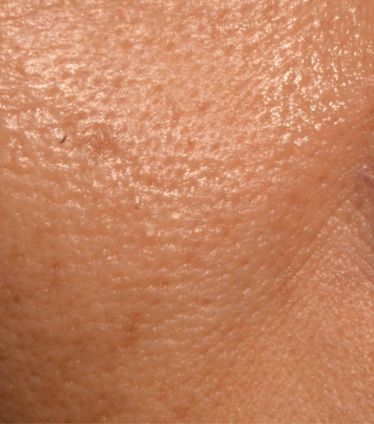 Image comparisons diamètre des pores (avant)