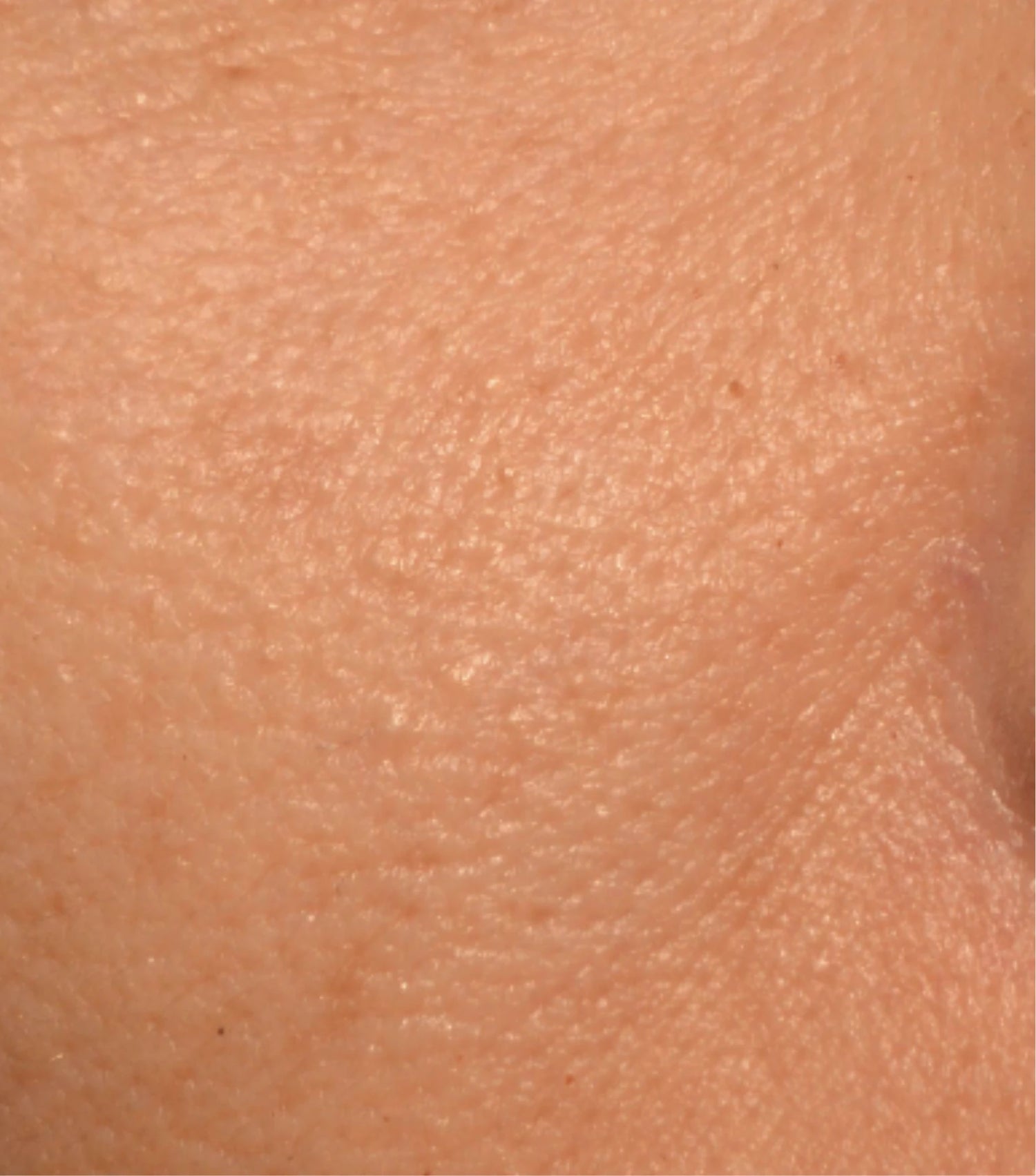 Image comparisons diamètre des pores (après)