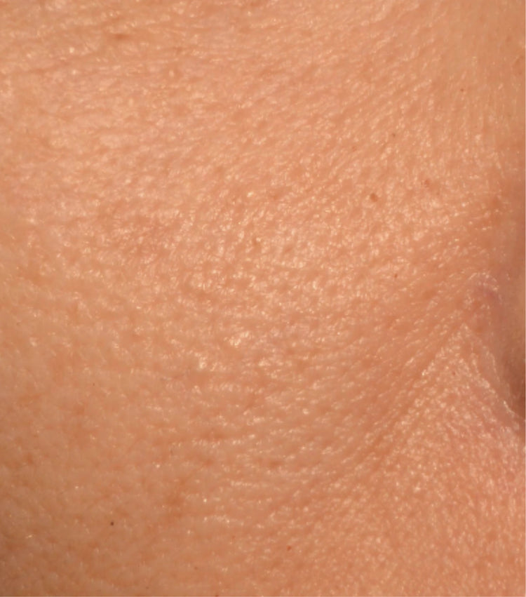 Image comparisons diamètre des pores (après)