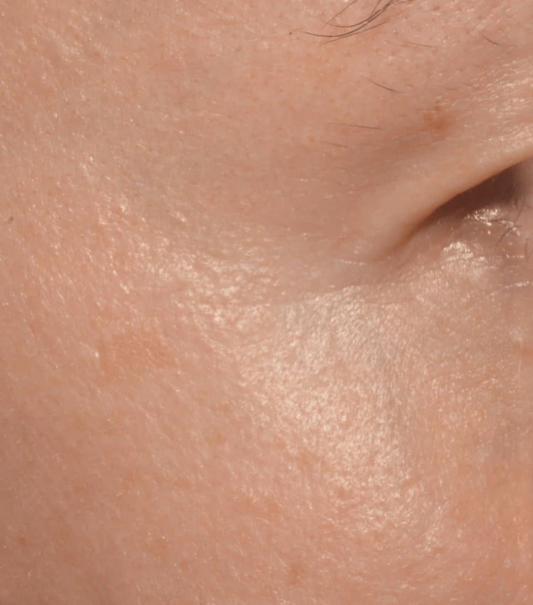 Close-up of a person's skin surface with visible pores and hair follicles.