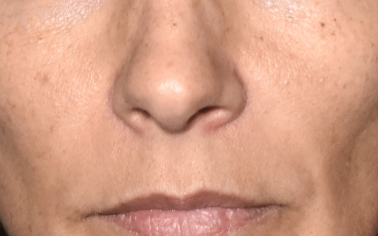 Image comparisons éclat du teint (avant)