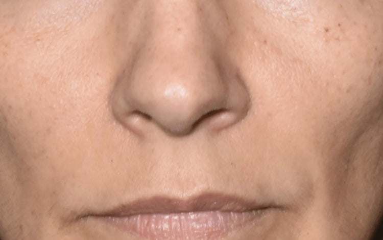 Image comparisons éclat du teint (après)