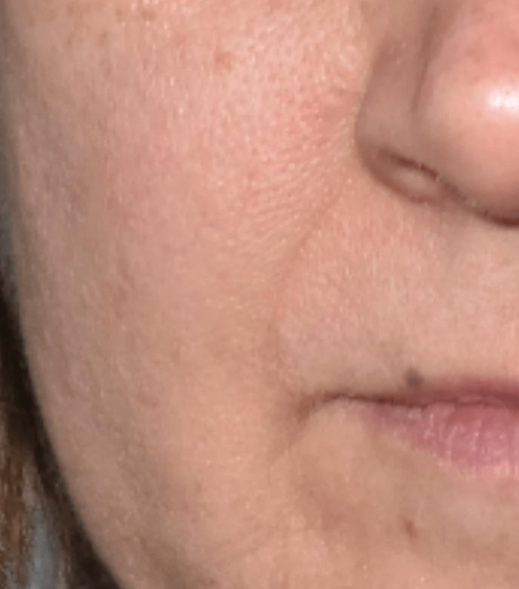 Image comparisons rides (avant)