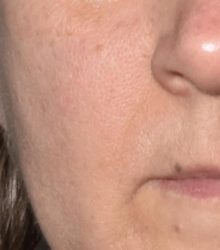 Image comparisons rides (après)