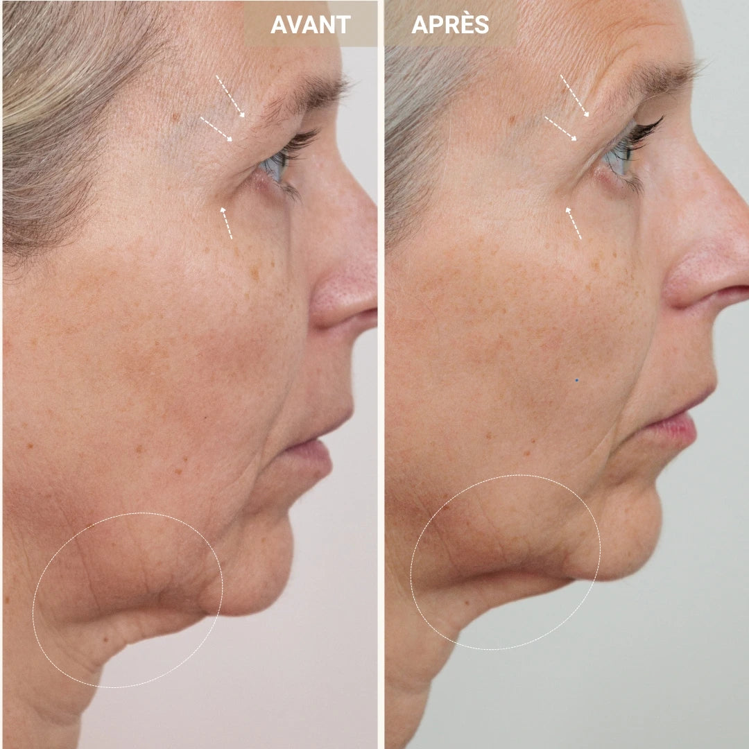 Sérum peptides de cuivre 2%