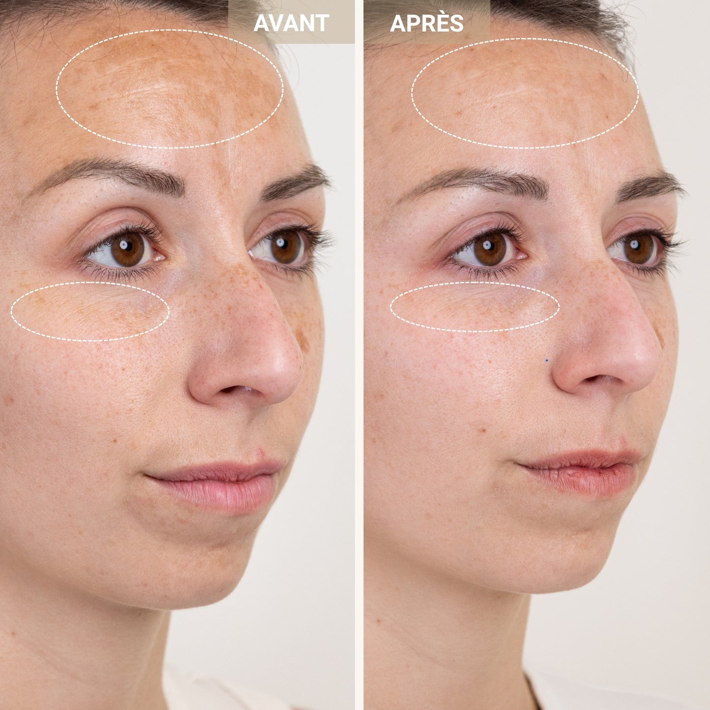 Soin Clarifiant Anti-Rougeurs