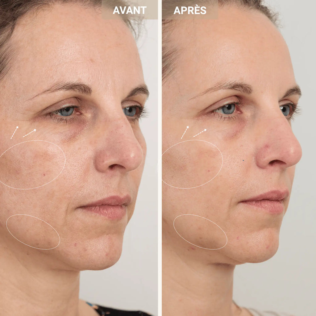 Intensive Radiance Cream