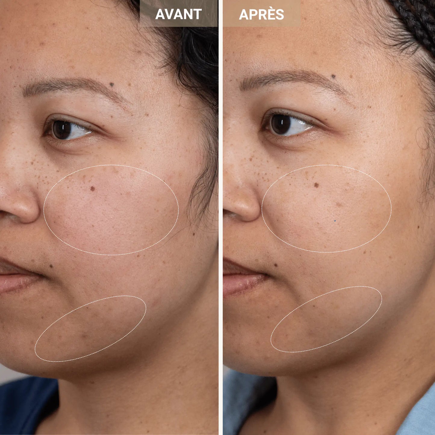 Intense Radiance Cream