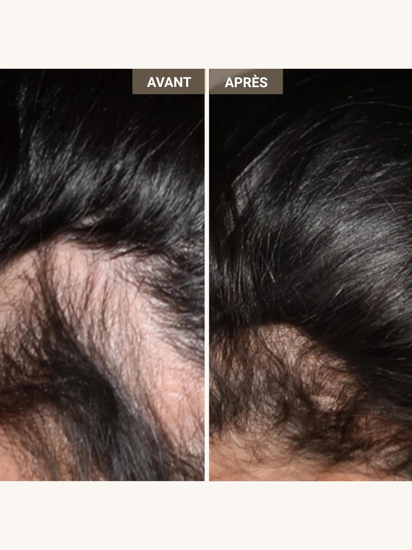 Anti-hair loss and regrowth hair helmet