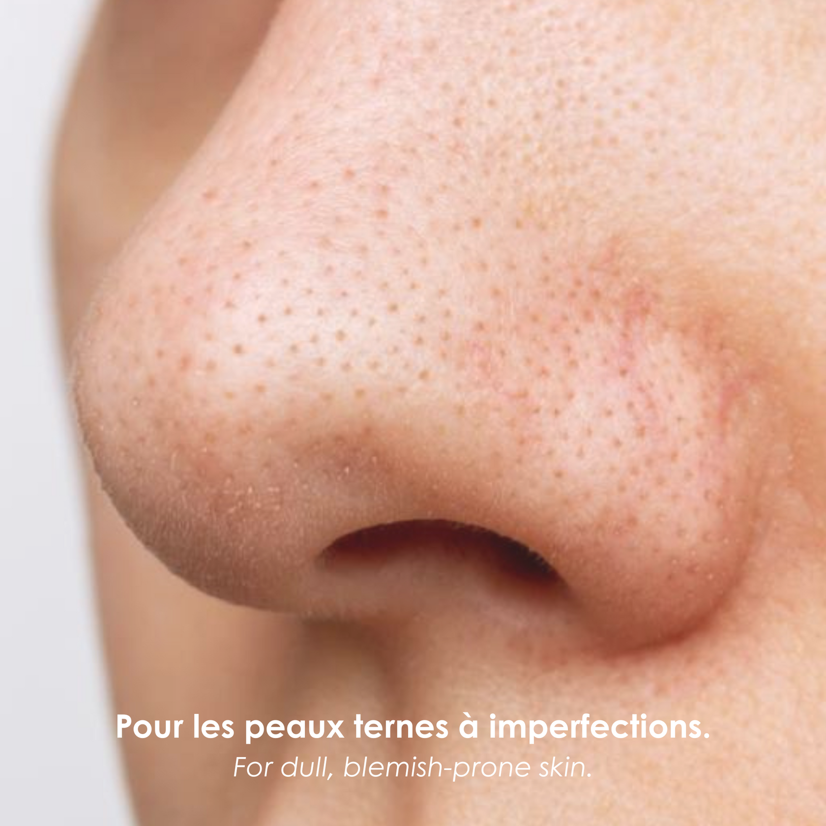 Lot De 5 Crèmes Gluta White Hyper - Éclaircissant, Anti-taches, Anti-âge Pour Le Corps