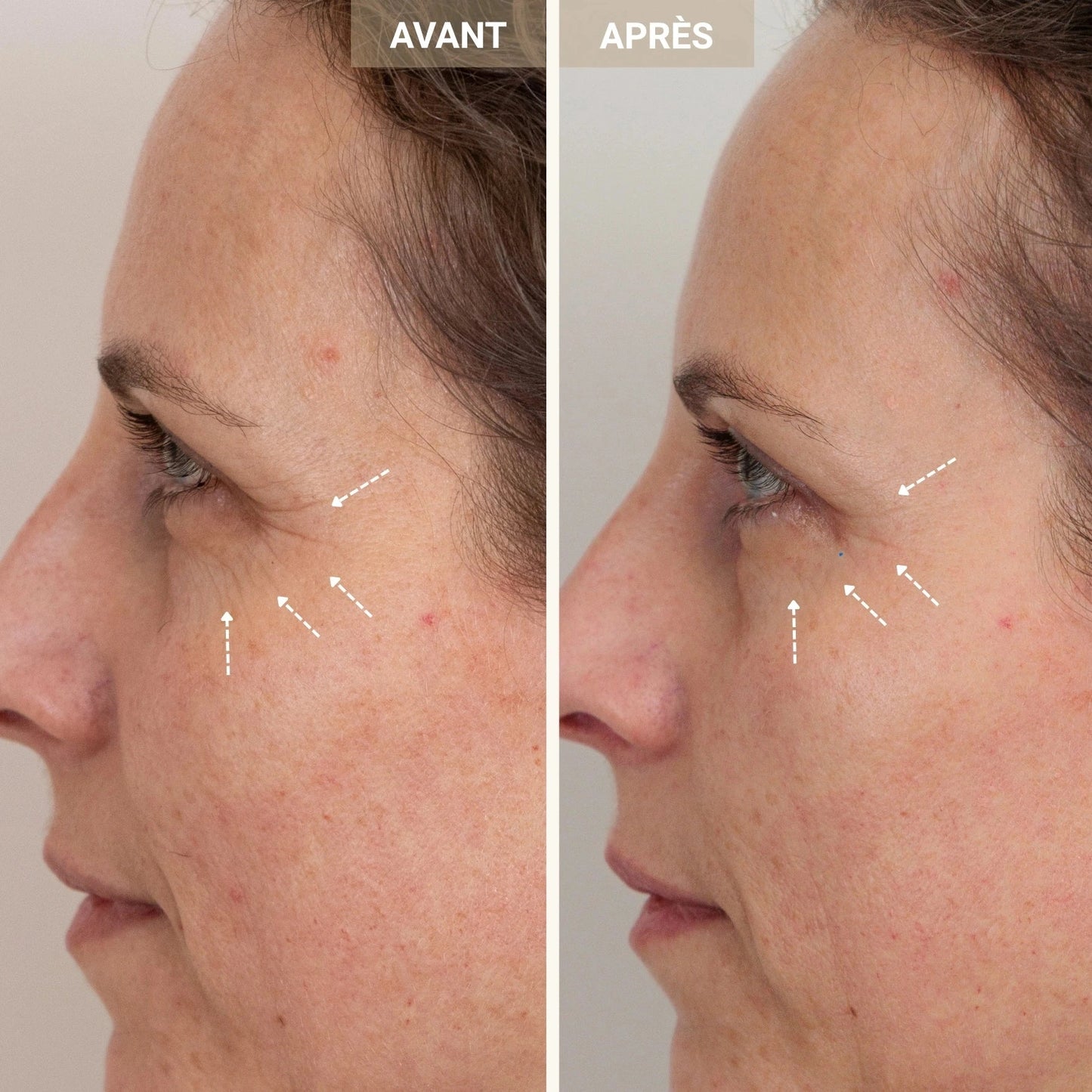 Sérum peptides de cuivre 2%