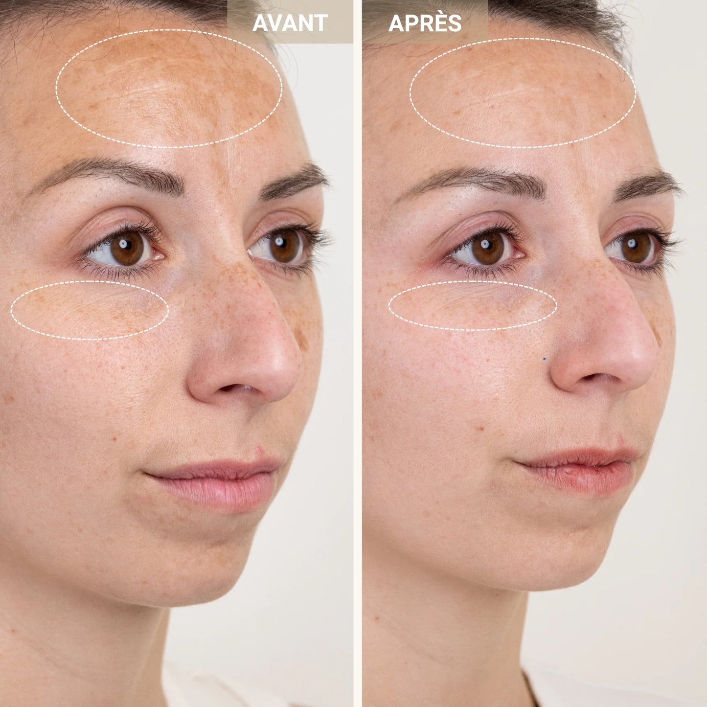 Anti-Redness Clarifying Care