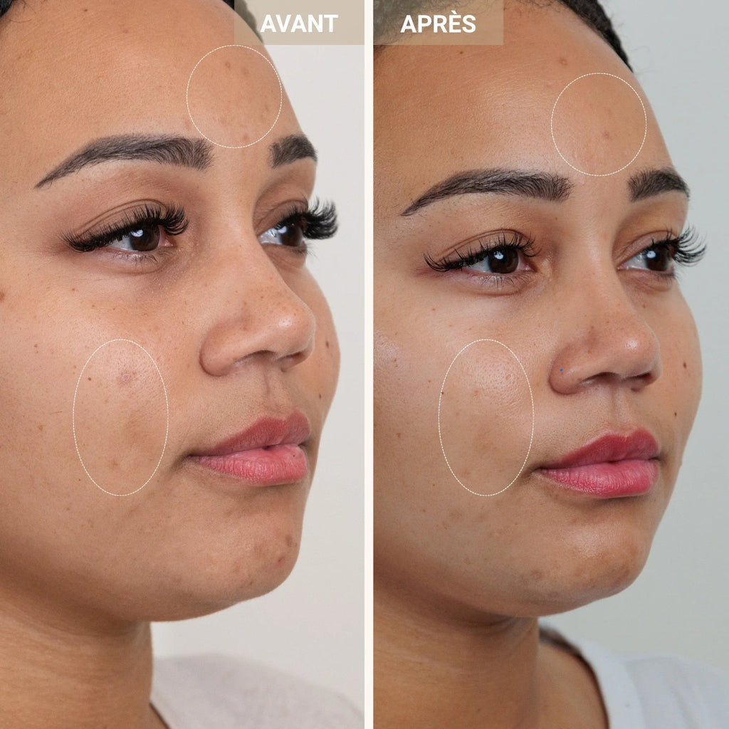 Anti-Redness Clarifying Care
