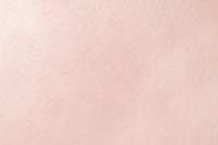 Phototype 1 : très blanche très claire